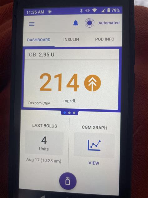 Dexcom G6 Problems 的图像结果