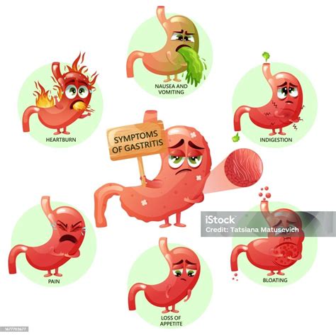 Ilustración de Infografía De Síntomas De Gastritis Con Personajes Estomacales De Dibujos ...