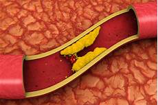 alimenti con colesterolo cattivo colesterolo cattivo ldl come prevenirlo e abbassarlo alimenti con colesterolo cattivo colesterolo cattivo ldl come prevenirlo e abbassarlo