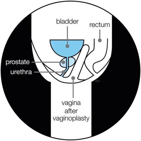 Sexual Health for Transgender and Gender Diverse Individuals ...