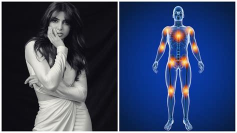 मायोसिटिस किसके कारण होता है? इससे बचाव | What is myositis caused ...