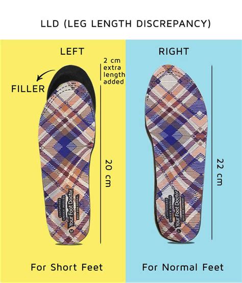 Customised Insole – Your Foot Doctor