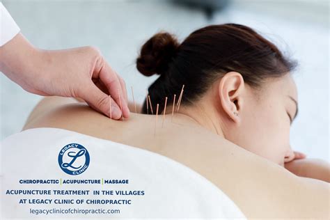 Dry Needling - Trigger Point Therapy - Legacy Clinic of Chiropractic