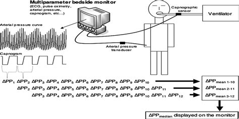 Image result for Pulse Pressure Variation Monitoring