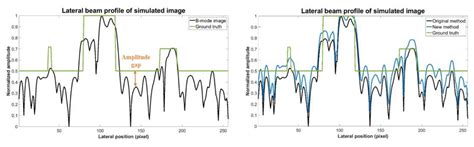 Estimation of Ultrasound Echogenicity Map from B-Mode Images Using ...