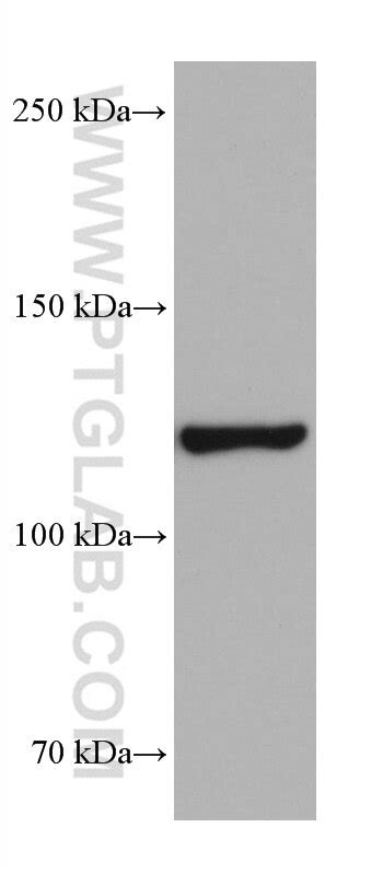 HIP1R antibody (68403-1-Ig) | Proteintech
