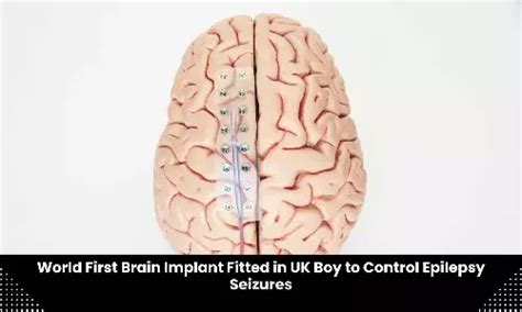 Neurology and Neurosurgery MDTV