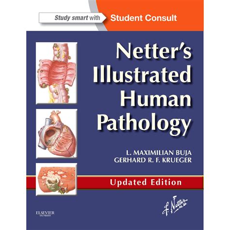 [หนังสือ] Netter's Illustrated Human Pathology แพทย์ แพทยศาสตร์ พยาธิ ...
