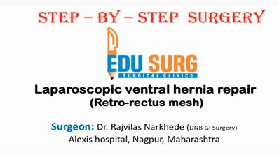 Videos - Step By Step Surgery | EduSurg