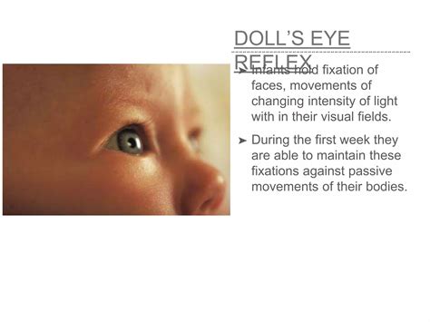Doll's Eye Reflex