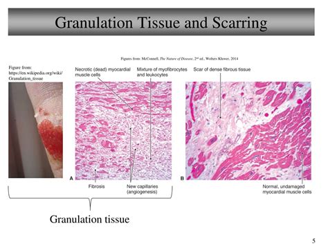 PPT - Chapter 2 Cellular Pathology: Injury, Inflammation, and Repair ...