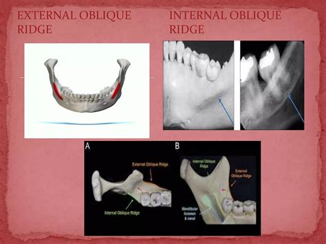 Surgical anatomy in periodontics | PPTX