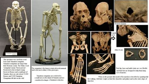 Image result for Skeleton Brain Exploding