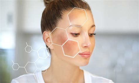 ¿Qué es Melasma?: causas, síntomas y posibles tratamientos
