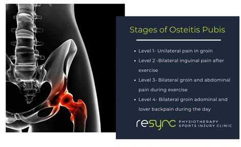 Pubic Bone Pain