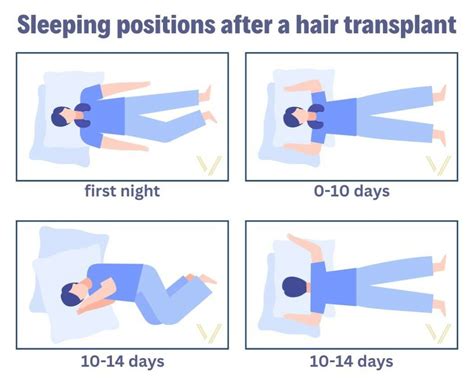How to sleep after a hair transplant?| Vantage Hair Clinic