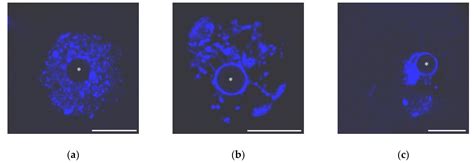 Heterochromatin Morphodynamics in Late Oogenesis and Early ...