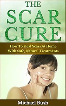 The Scar Cure: How To Heal Scars At Home With Safe, Natural Treatments ...