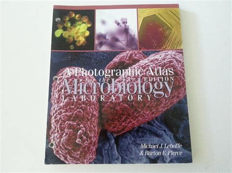 Image result for Atlas Micro of Microstructure Book