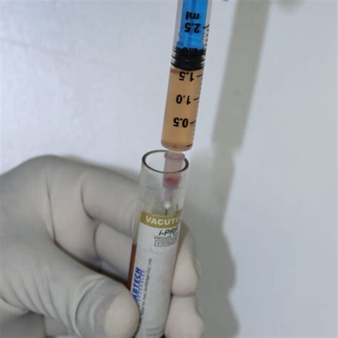 PRF Protocol 的图像结果