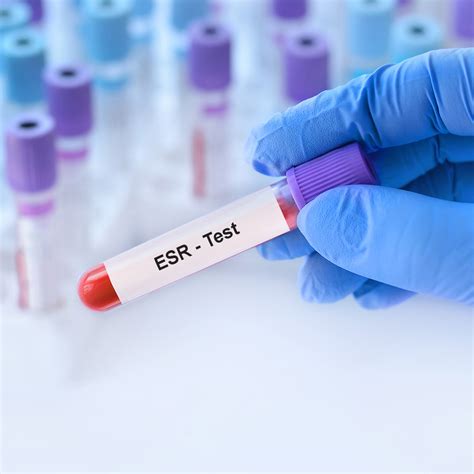 ESR Testing 的图像结果