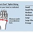 Image result for Comfort Cool CMC Splint