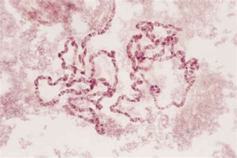 Image result for Interphase Movement