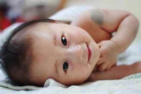 宝宝胎记竟是高智商象征，这几种胎记你家宝宝有么