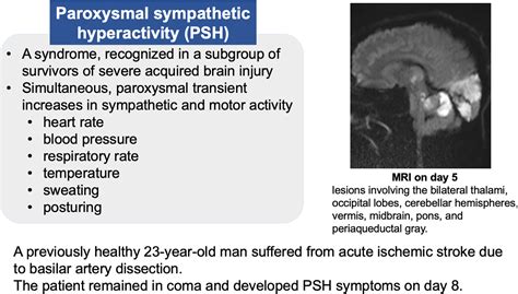 A case of paroxysmal sympathetic hyperactivity following cerebral ...