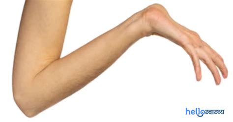 जेन्सन मेटाफिसियल चोंड्रोडिसप्लासिया रेयर डिजीज के बारे में जानिए ...