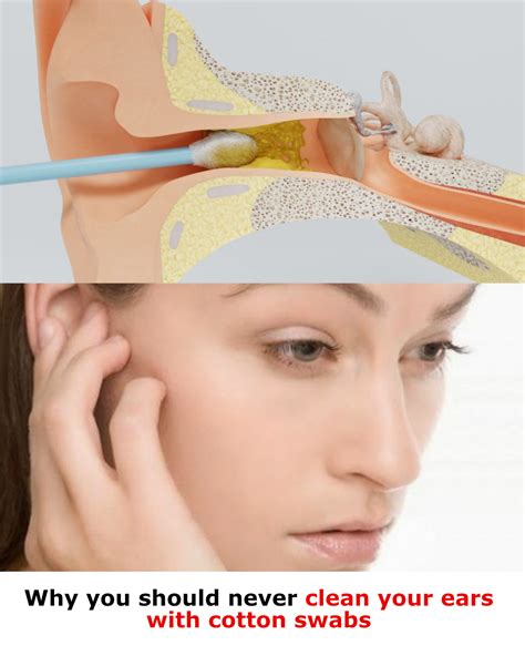 why you should never clean your ears with cotton swabs