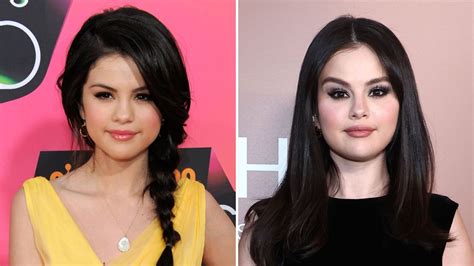 Selena Gomez Plastic Surgery
