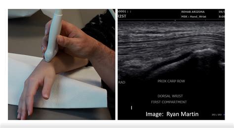 Future-Proof Your Practice: The Clinical and Financial Edge of MSK Ultrasound - Free MSK Webinar