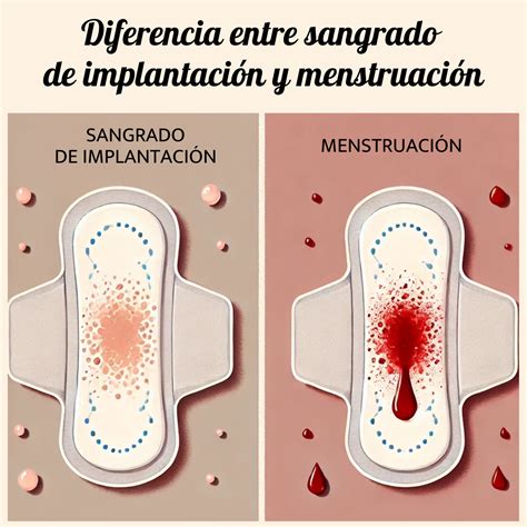 Sangrado de implantación: Síntomas y cómo identificarlo