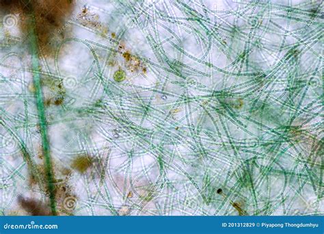 Anabaena is a Genus of Filamentous Cyanobacteria. Stock Image - Image ...