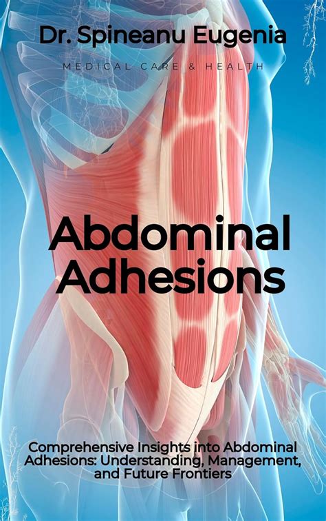 Comprehensive Insights into Abdominal Adhesions: Understanding ...