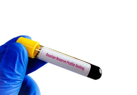 Image result for Ovary Function Test