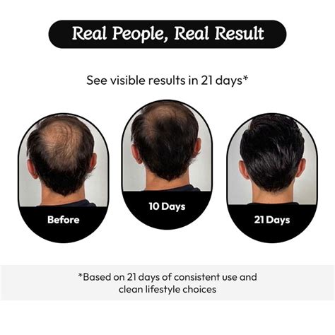 Hair Fall Control Serum - Direct Scalp Treatment | Wayveda