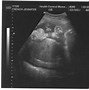 Image result for Sonograms