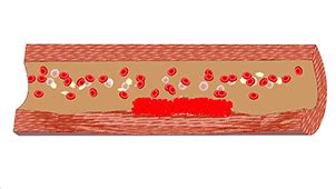 一次性使用定量采血管 微量采血管 定量采血吸管 规格齐全-阿里巴巴