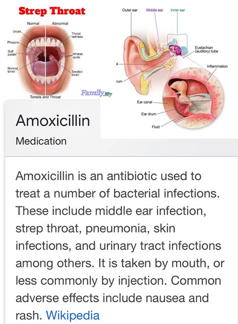 Will Amoxicillin Treat Strep