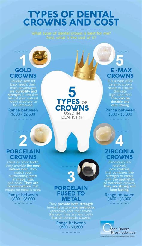 Types Of Crown