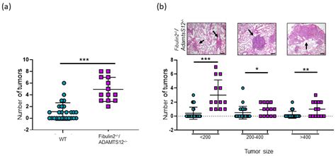 Lung Inflammatory Phenotype in Mice Deficient in Fibulin-2 and ADAMTS-12