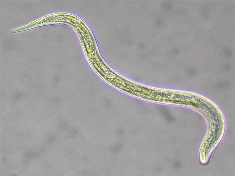 Phylum Nematoda Roundworms