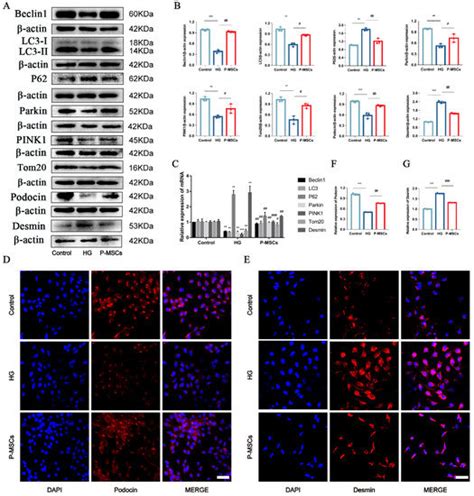 Placental Mesenchymal Stem Cells Alleviate Podocyte Injury in Diabetic ...