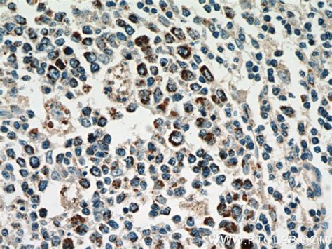 HSP60 antibody (66041-1-Ig) | Proteintech