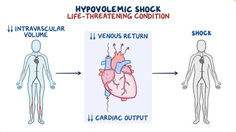Shock Pathophysiology 的图像结果