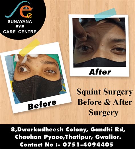 Sunayana Eye Care Center – Center For Advance Eye Care