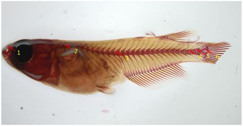 Recent Advances in Bioimage Analysis Methods for Detecting Skeletal ...