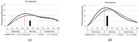 Obstacle Crossing in Older Adults with Total Knee Arthroplasty at the ...